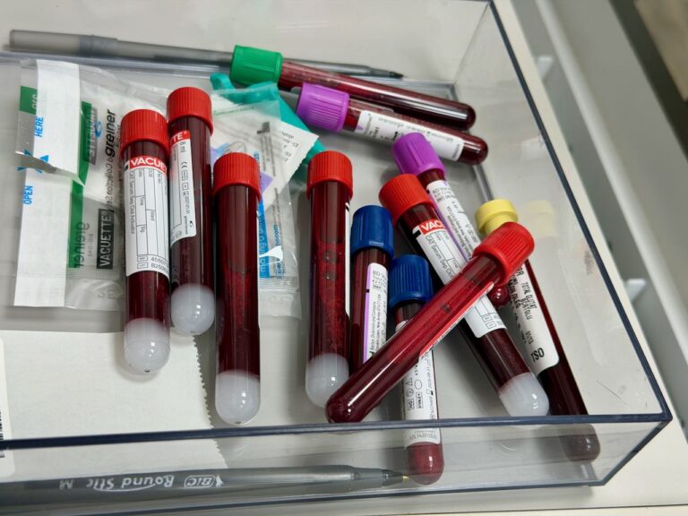 Liquid Biopsy Screening Trials Report Early Findings A blood sample in a laboratory